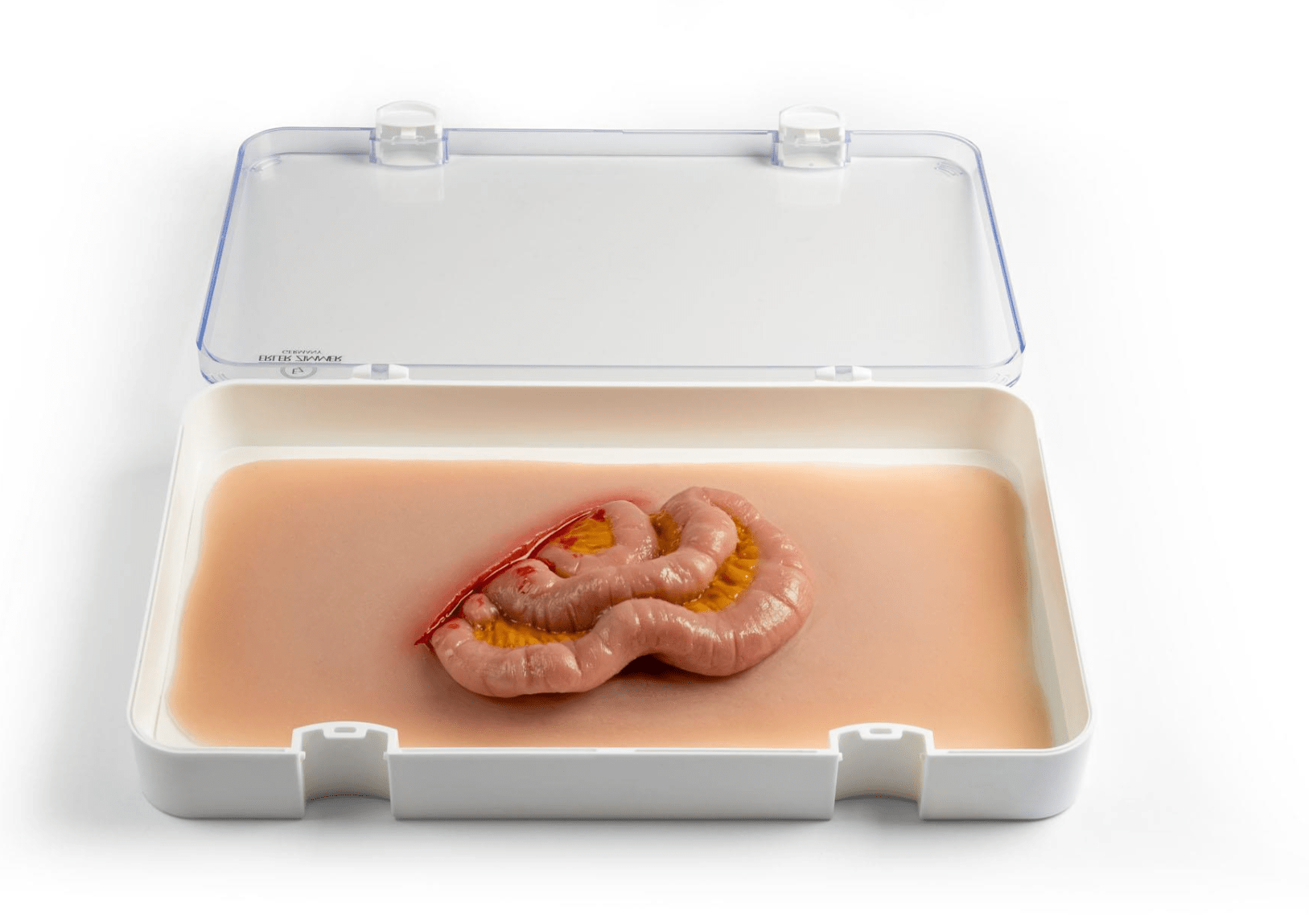 Wundmoulage Dünndarmaustritt - Erler - Zimmer